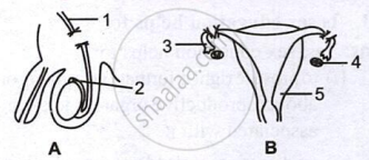 Diagrams show vasectomy in males and tubectomy in females as permanent surgical contraceptive methods.
